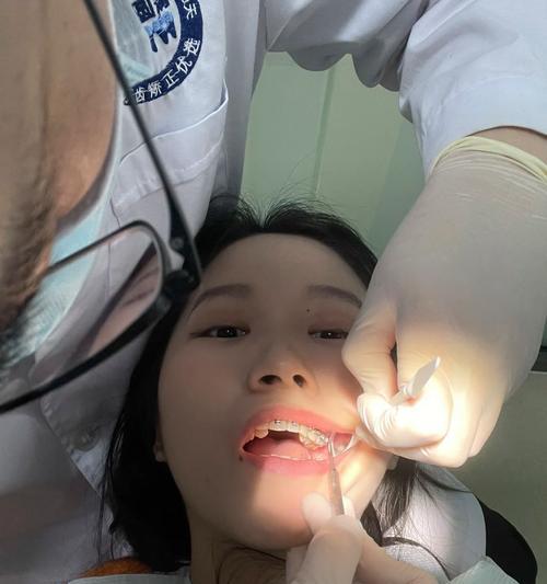 国庆节拔牙作文500字怎么写？（《国庆节的拔牙记》）